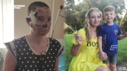 "На блокпостах удивлялись: "Кто ж это вас так?" Так это ж вы нас так и били!" Семья из Мариуполя выжила после попадания снаряда "На блокпостах удивлялись: "Кто ж это вас так?" Так это ж вы нас так и били!" Семья из Мариуполя выжила после попадания снаряда