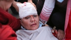 К вечеру, когда у стелы "Минск – город герой" собрались около пяти тысяч человек, силовики <a href="/a/protesty-minsk/30854377.html">стали действовать крайне жестко</a>: применялись водометы с оранжевой жидкостью вместо воды, дубинки, электрошокеры, слезоточивый газ. Есть раненые